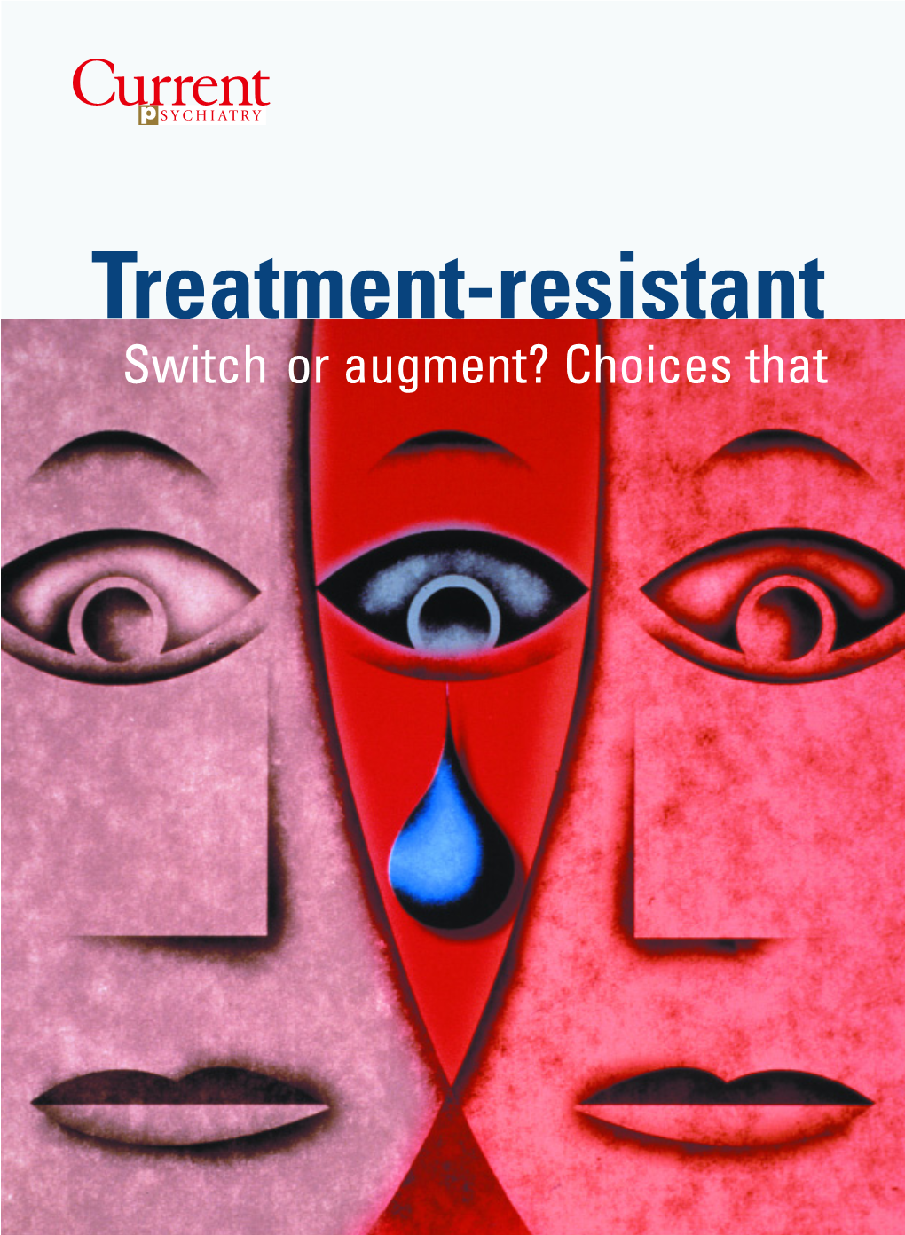 Treatment-Resistant Switch Or Augment? Choices That Depression Improve Response Rates