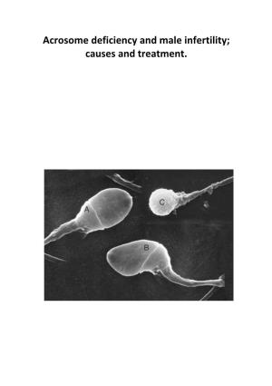 Acrosome Deficiency and Male Infertility; Causes and Treatment. the Picture on the Cover (Hirsh, 2003) Shows Differences in Morphology in Spermatozoa