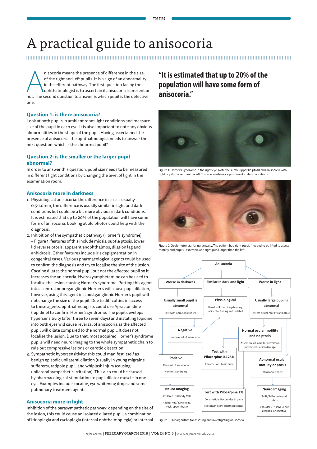 A Practical Guide to Anisocoria