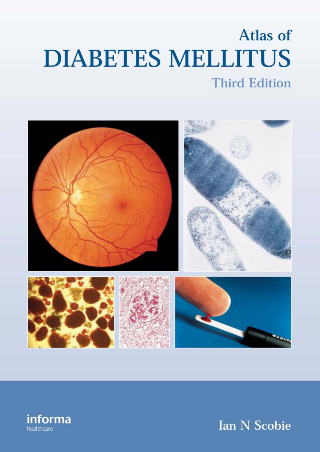 Atlas of DIABETES MELLITUS Scobie Chapter Prelims 28/7/06 11:00 Page Ii Scobie Chapter Prelims 28/7/06 11:00 Page Iii