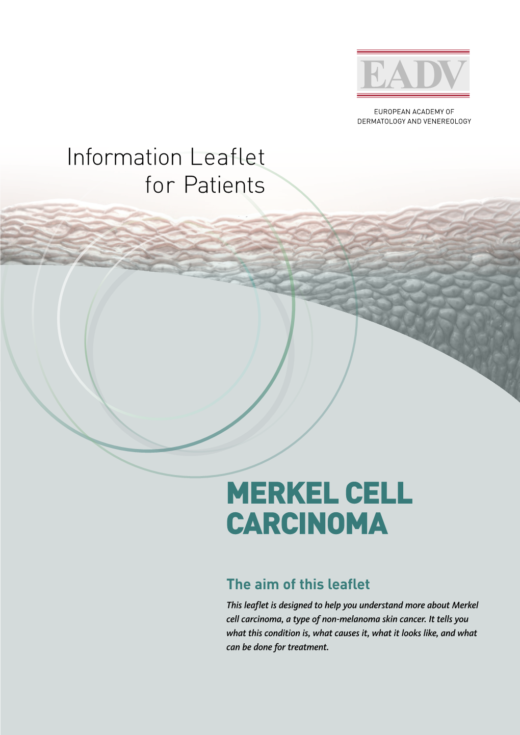 Merkel Cell Carcinoma