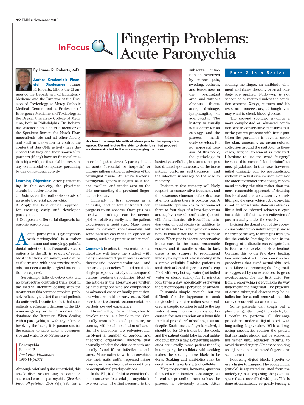 Acute Paronychia