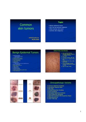 Common Skin Tumors