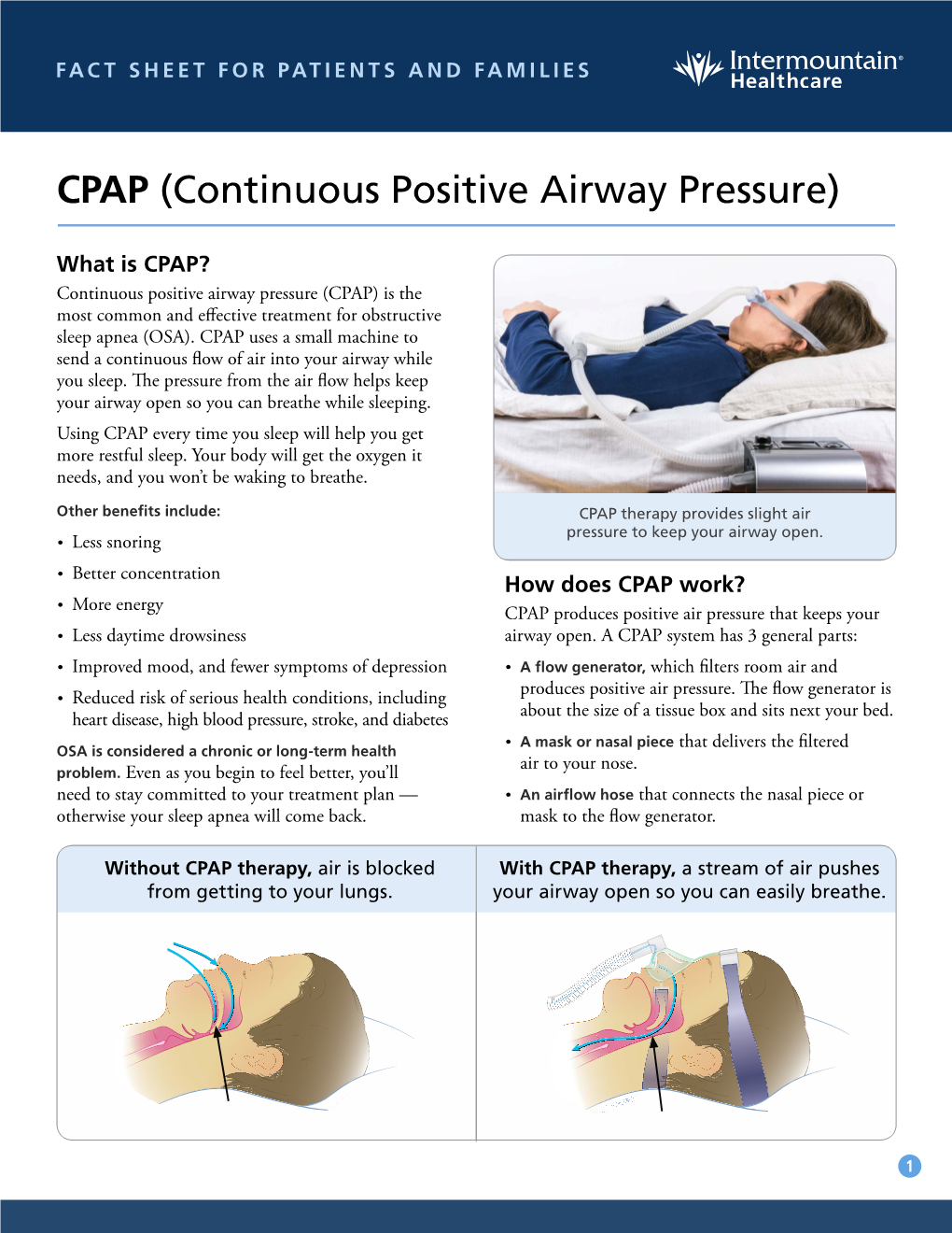 CPAP (Continuous Positive Airway Pressure)