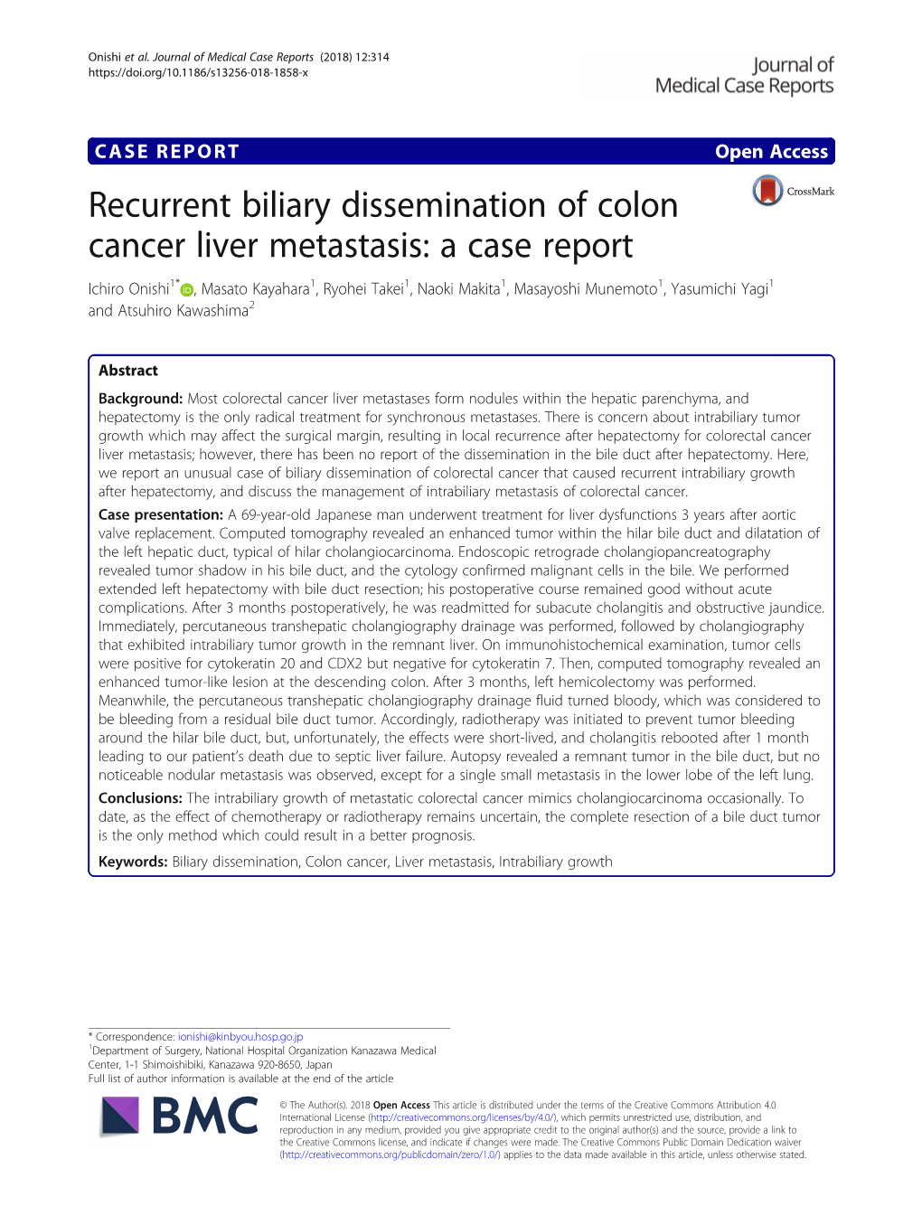 Recurrent Biliary Dissemination of Colon Cancer Liver Metastasis: A