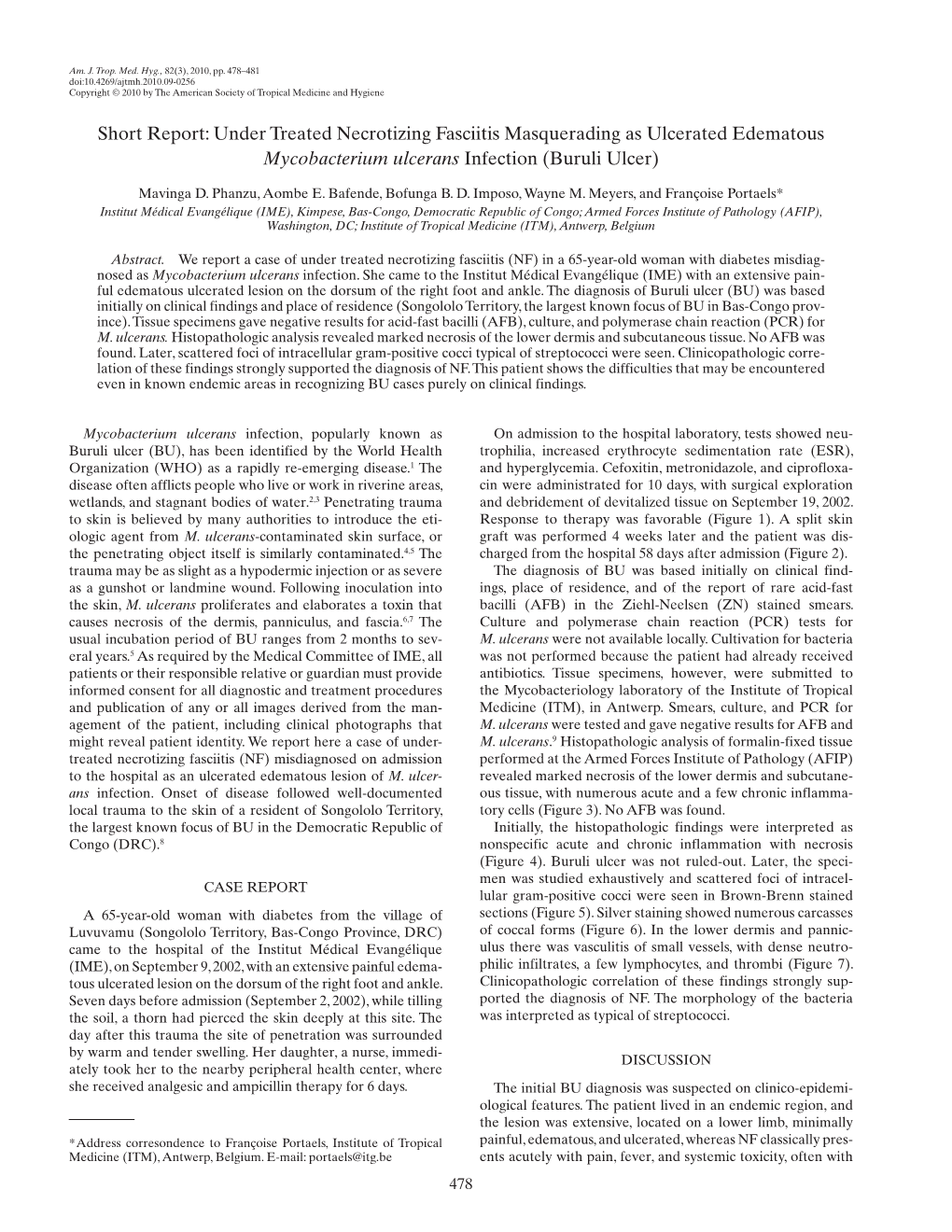 Under Treated Necrotizing Fasciitis Masquerading As Ulcerated Edematous Mycobacterium Ulcerans Infection (Buruli Ulcer)