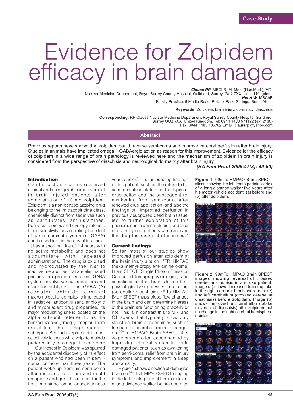 Evidence for Zolpidem Efficacy in Brain Damage Clauss RP, Mbchb, M