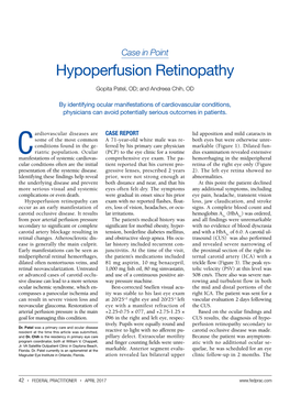 Hypoperfusion Retinopathy