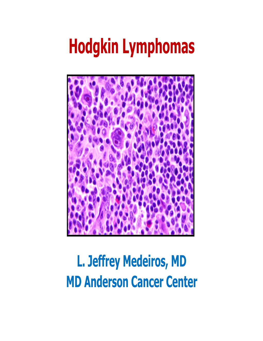 Hodgkin Lymphomas