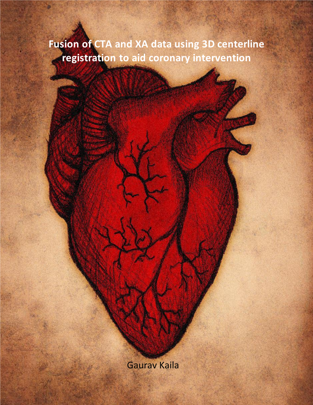 Fusion of CTA and XA Data Using 3D Centerline Registration to Aid Coronary Intervention