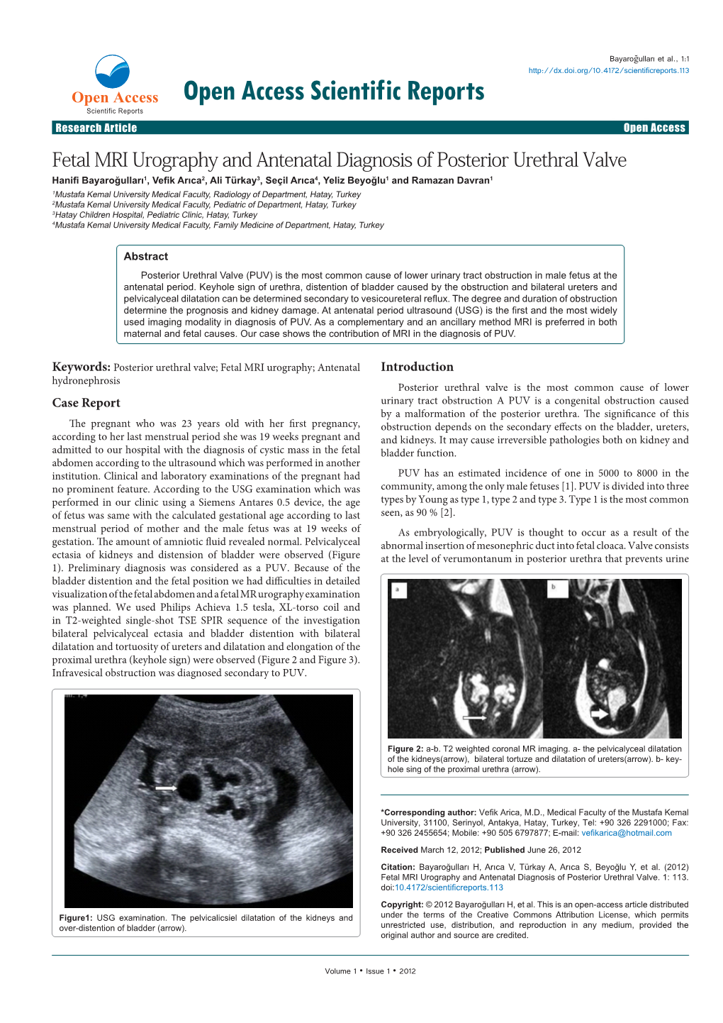 Fetal MRI Urography and Antenatal Diagnosis of Posterior Urethral Valve