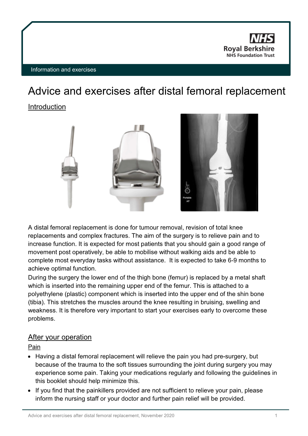 Advice and Exercises After Distal Femoral Replacement Introduction