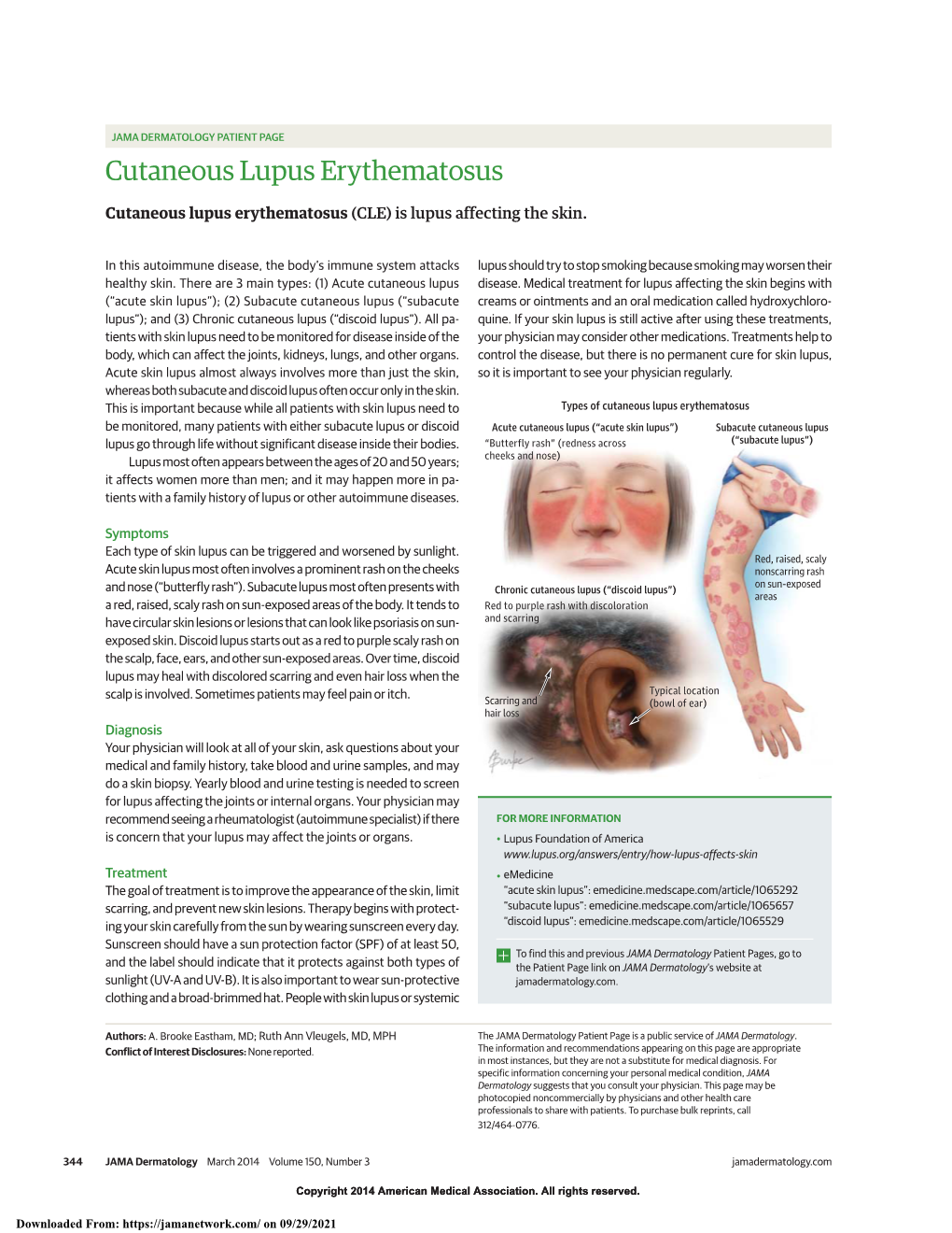 Cutaneous Lupus Erythematosus