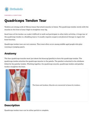 Quadriceps Tendon Tear