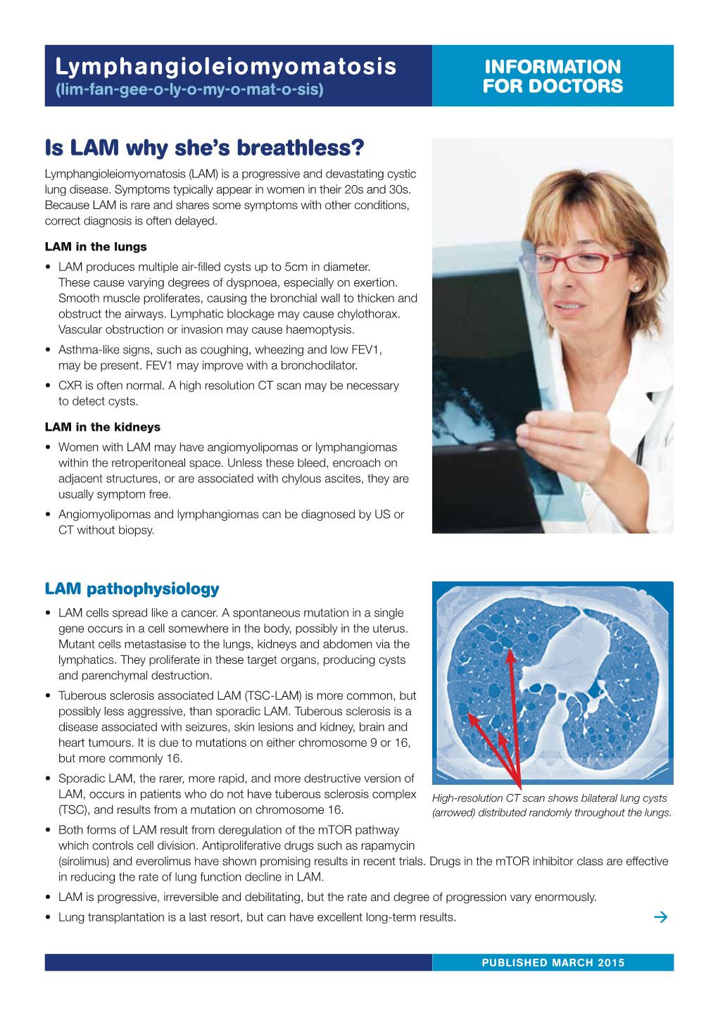 Lymphangioleiomyomatosis INFORMATION (Lim-Fan-Gee-O-Ly-O-My-O-Mat-O-Sis) for DOCTORS
