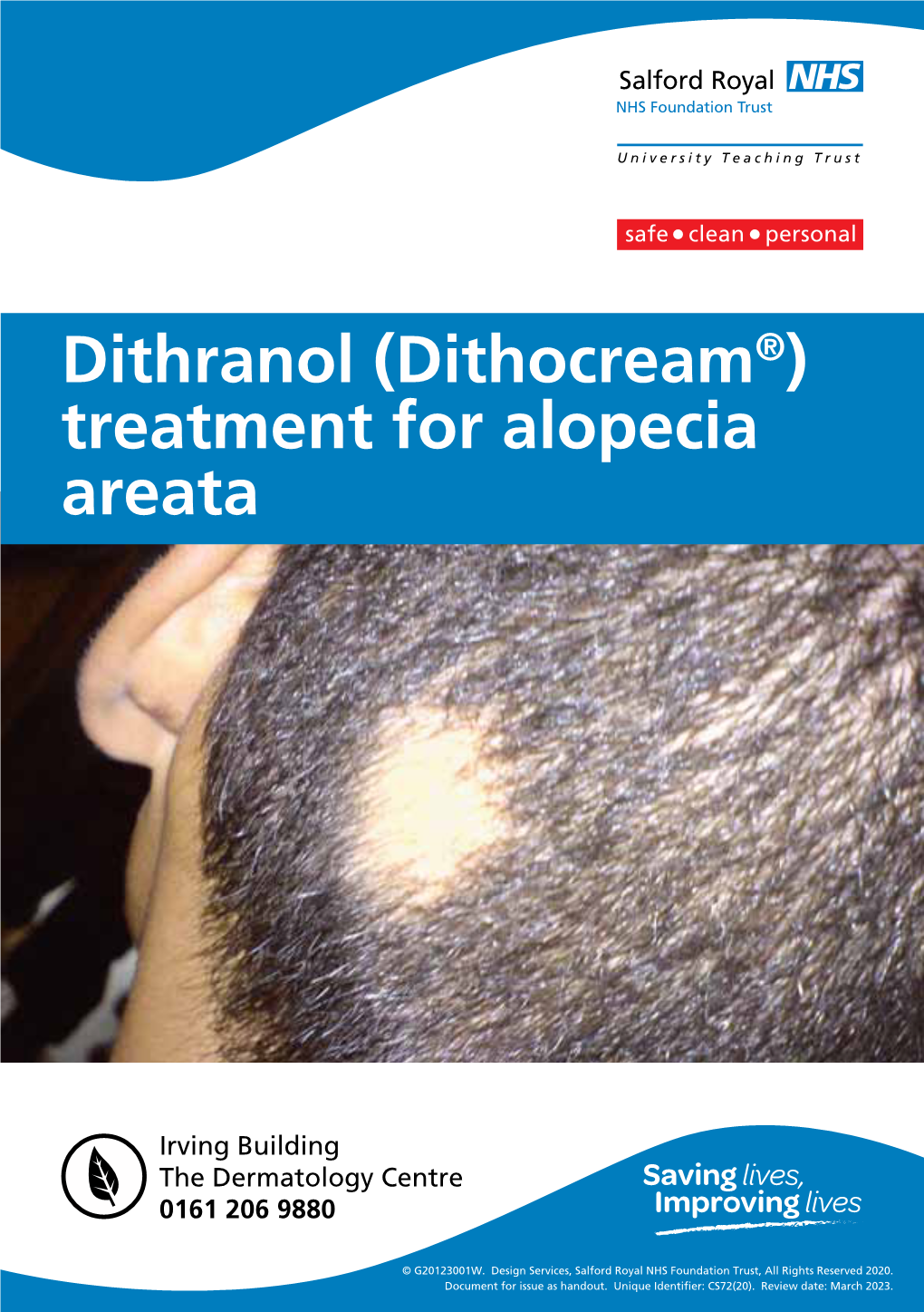 Treatment for Alopecia Areata