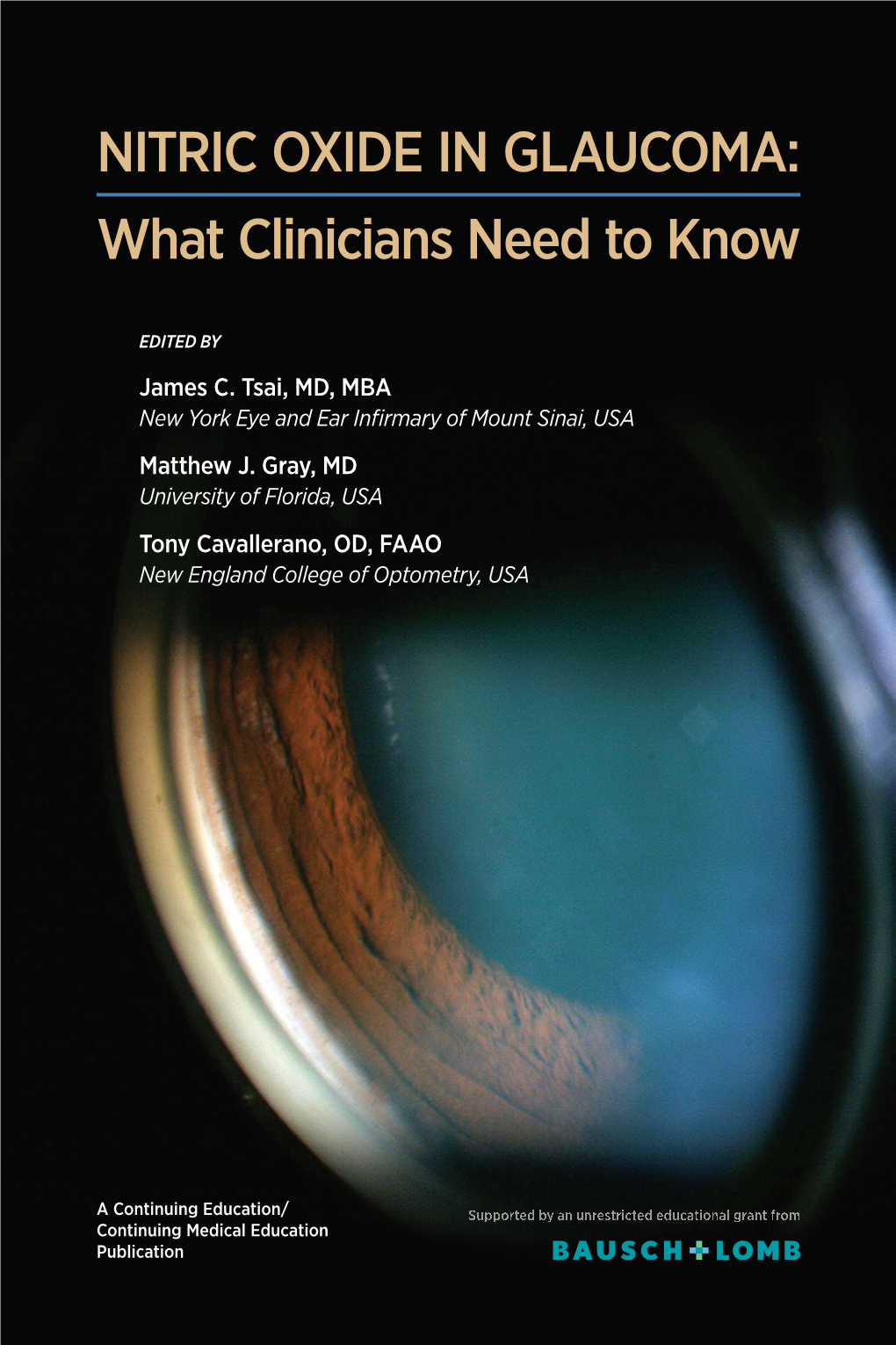 NITRIC OXIDE in GLAUCOMA: What Clinicians Need to Know