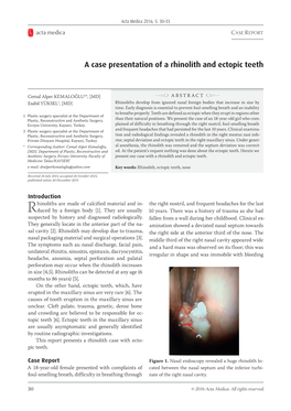 A Case Presentation of a Rhinolith and Ectopic Teeth