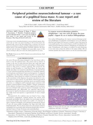Peripheral Primitive Neuroectodermal Tumour – a Rare Cause of a Popliteal Fossa Mass: a Case Report and Review of the Literature