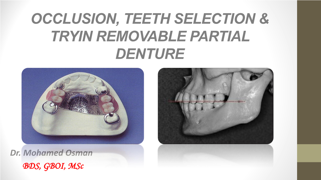 Occlusion, Teeth Selection & Tryin Removable Partial Denture - DocsLib