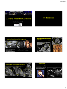 A Medley of Fetal Brain Anomalies No Disclosures