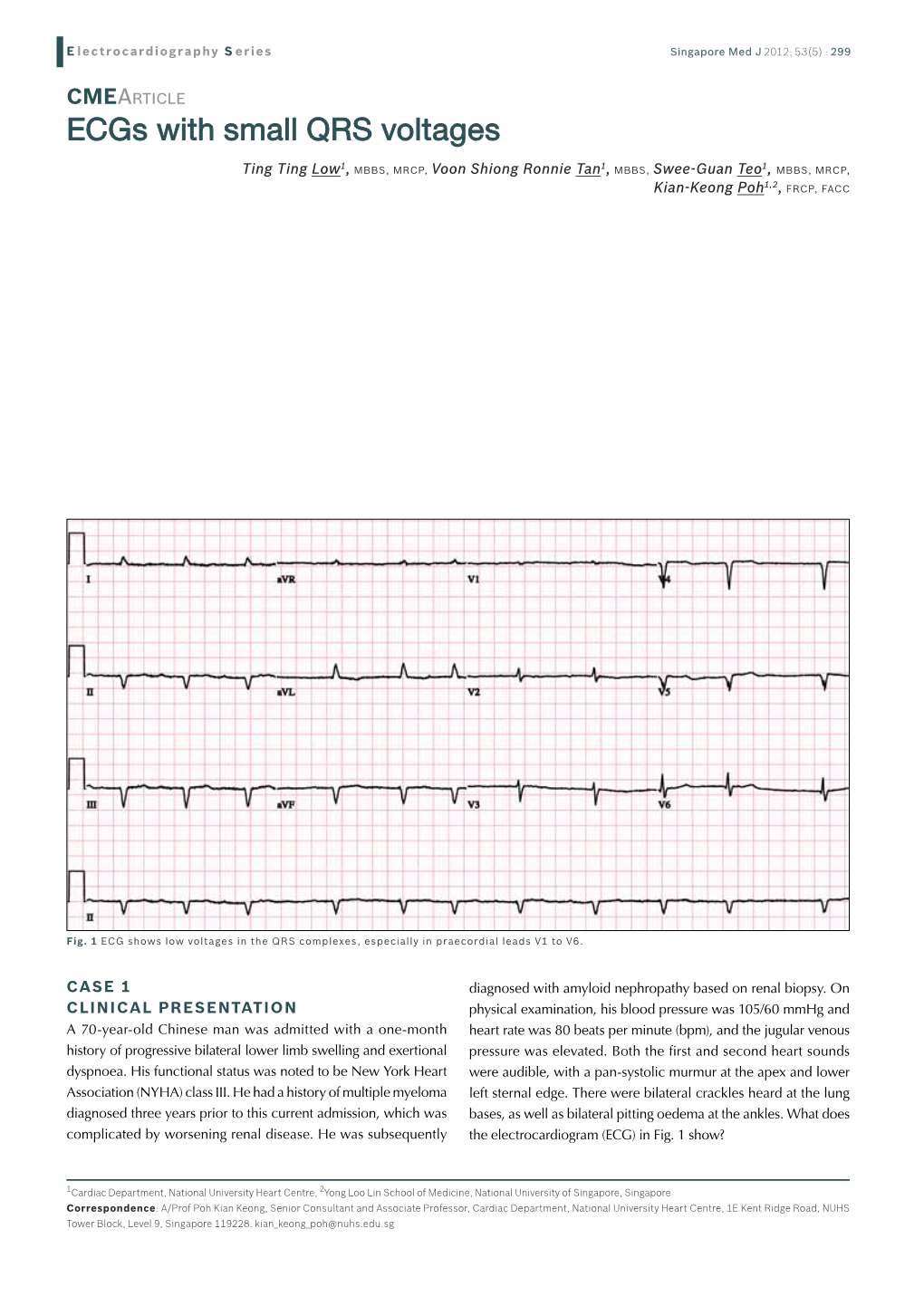 Ecgs with Small QRS Voltages
