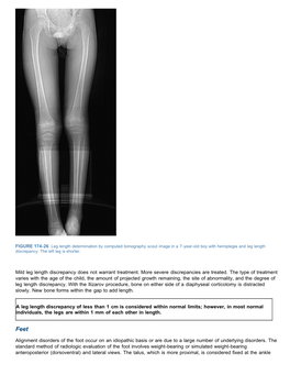 Foot-Disorders-In-Alignment.Pdf