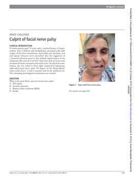 Culprit of Facial Nerve Palsy
