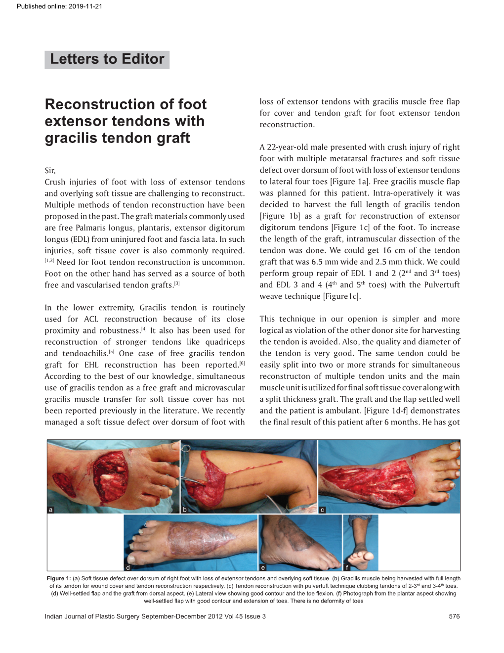 Reconstruction of Foot Extensor Tendons with Gracilis Tendon Graft Letters to Editor