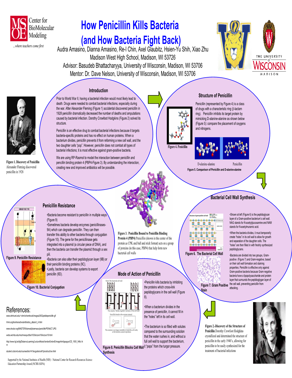 Will Penicillin Kill Tooth Infection