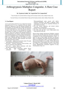 Arthrogryposis Multiplex Congenita: a Rare Case Report