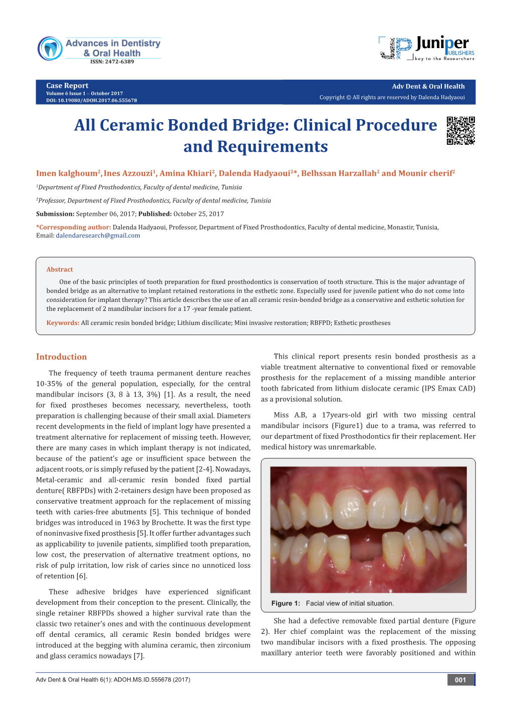 Ceramic Bonded Bridge: Clinical Procedure and Requirements