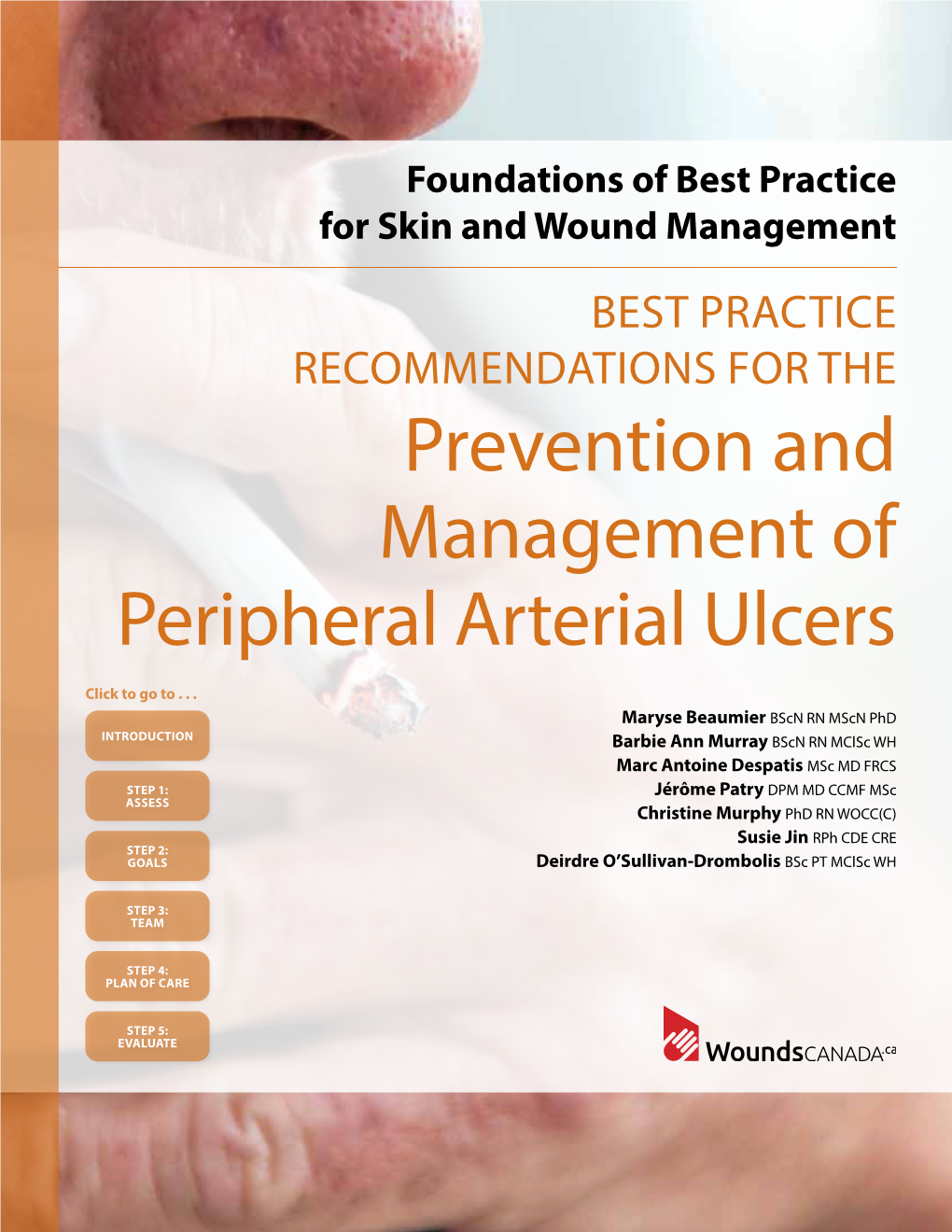 Prevention and Management of Peripheral Arterial Ulcers