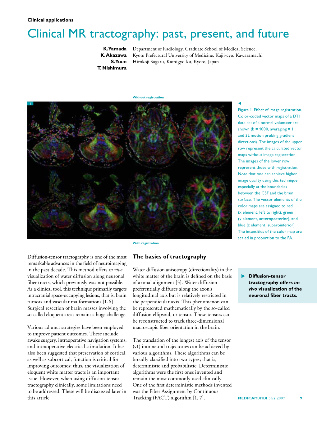 Clinical MR Tractography: Past, Present, and Future