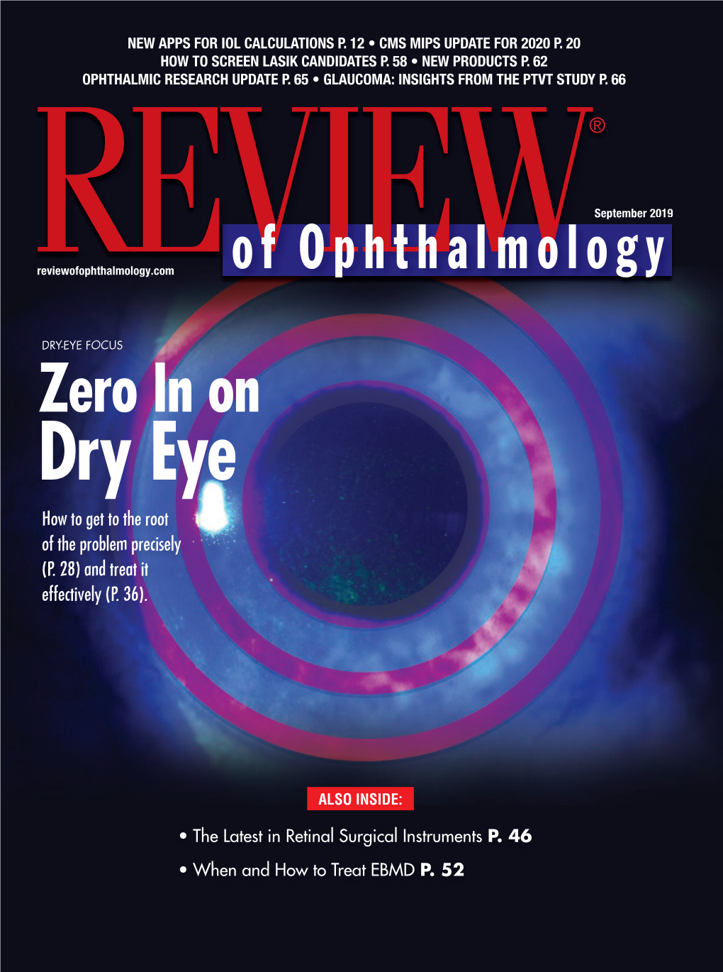 Dry-Eye Diagnosis and Treatmentreview of Ophthalmology Vol