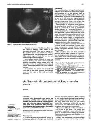 Axillary Vein Thrombosis Mimicking Muscular Strain 233