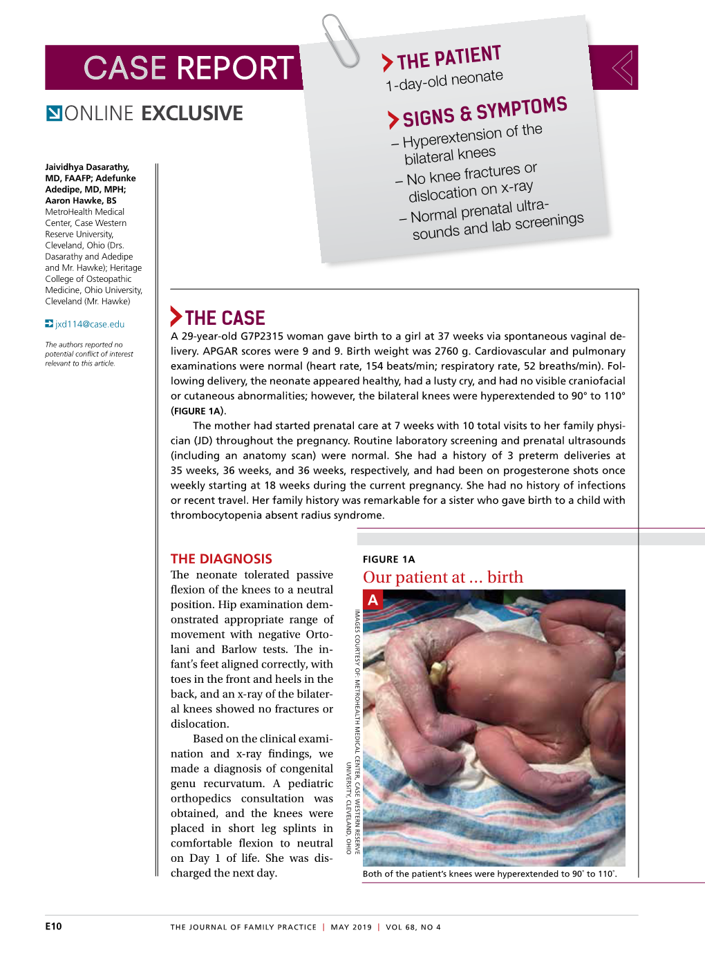 CASE REPORT the PATIENT 1-Day-Old Neonate ONLINE EXCLUSIVE SIGNS & SYMPTOMS – Hyperextension of The