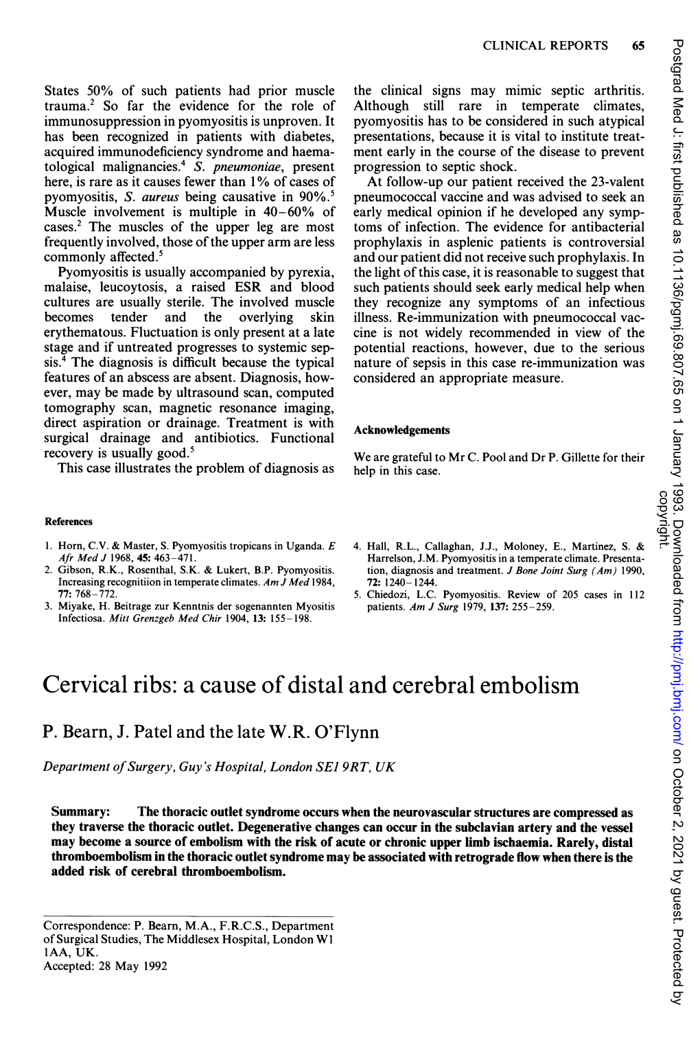 Cervical Ribs: a Cause of Distal and Cerebral Embolism