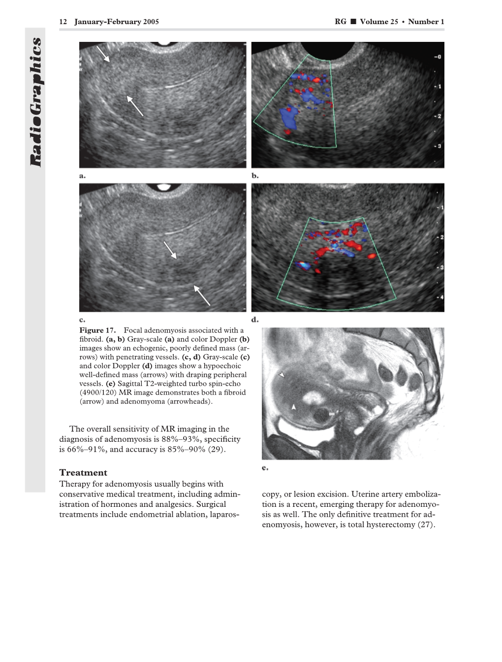 Radiographics