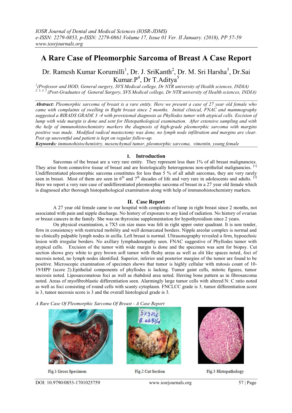 A Rare Case of Pleomorphic Sarcoma of Breast a Case Report