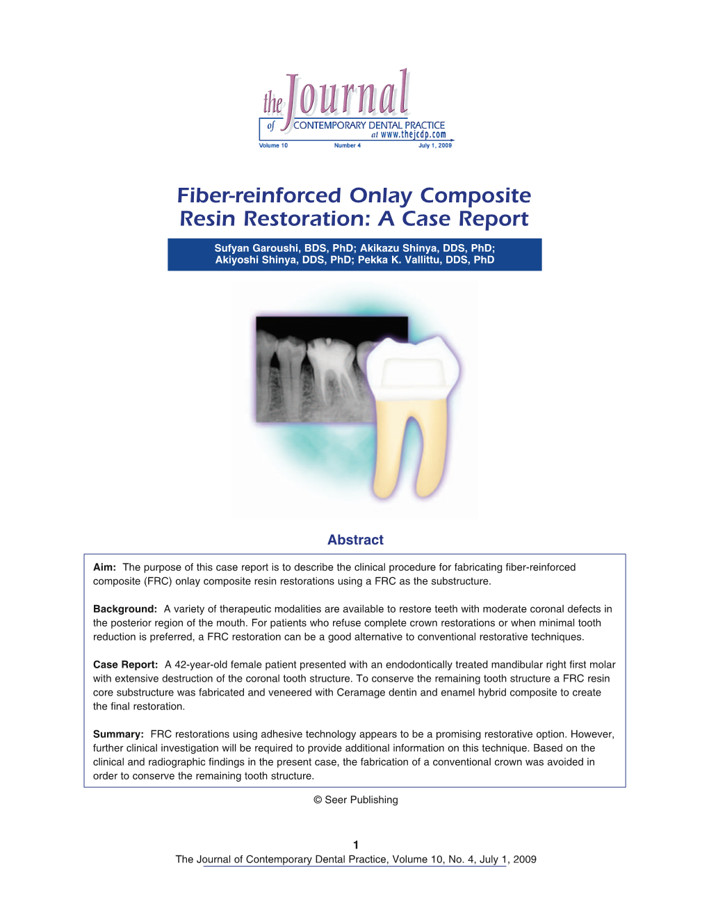 Fiber-Reinforced Onlay Composite Resin Restoration: a Case Report