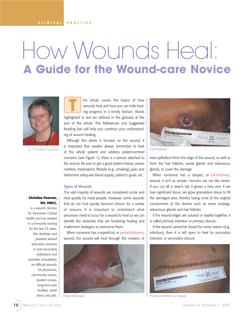 How Wounds Heal: a Guide for the Wound-Care Novice