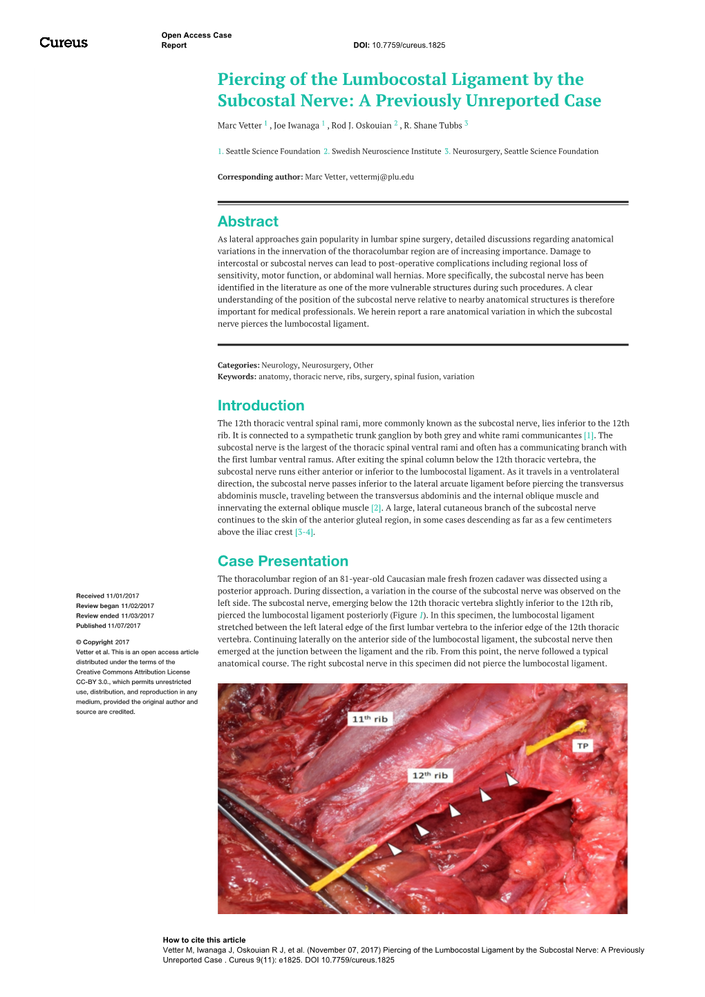 Piercing of the Lumbocostal Ligament by the Subcostal Nerve: a Previously Unreported Case