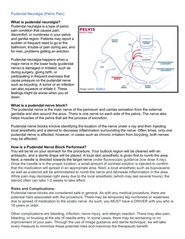 Pudendal Neuralgia Is a Type of Pelvic Pain Condition That Causes Pain, Discomfort, Or Numbness in Your Pelvis and Genital Region