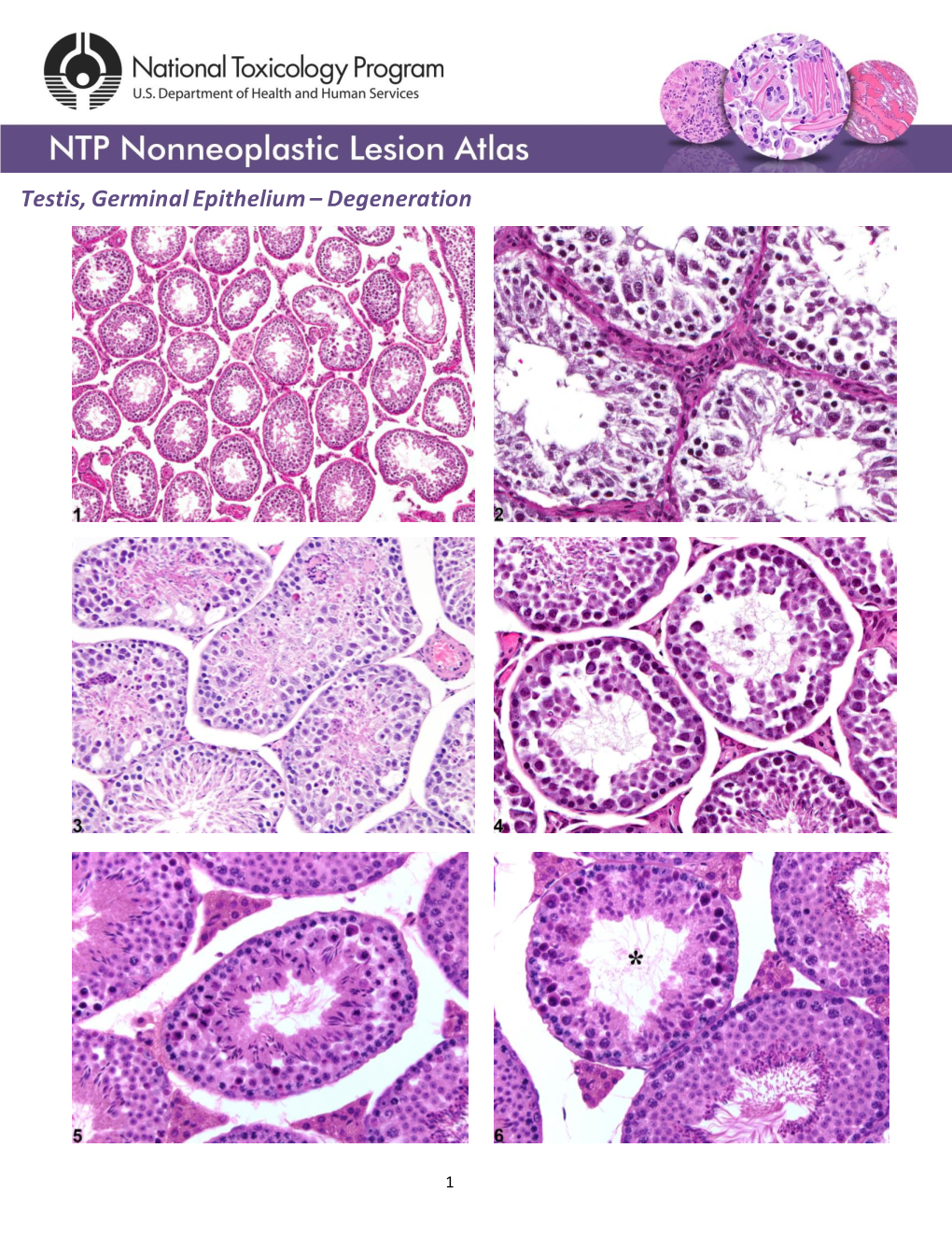 Testis, Germ Cell