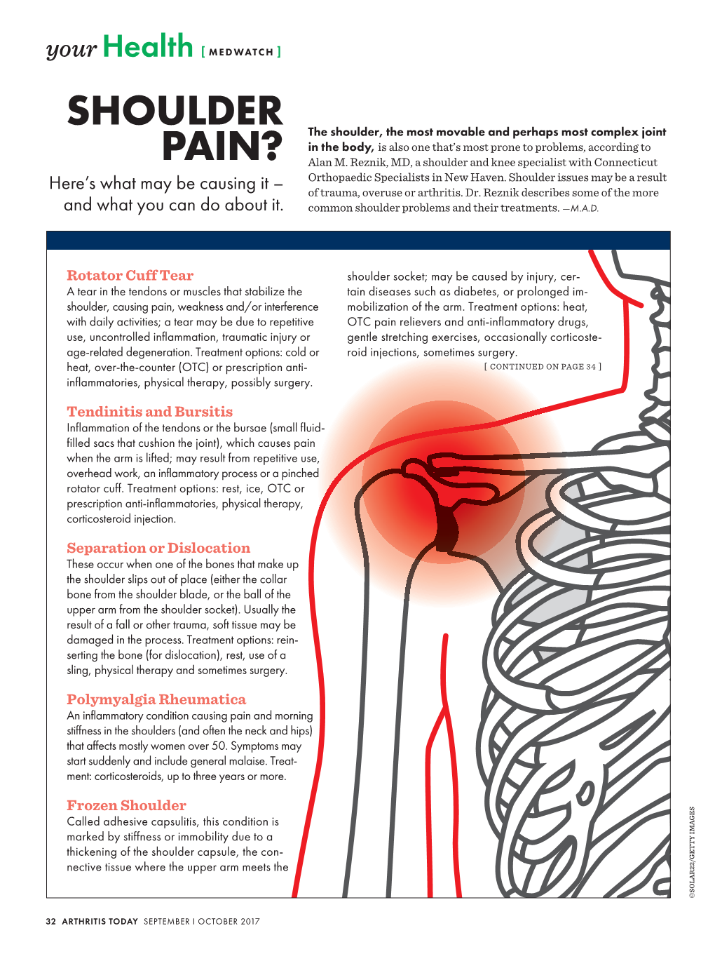 Shoulder Pain?