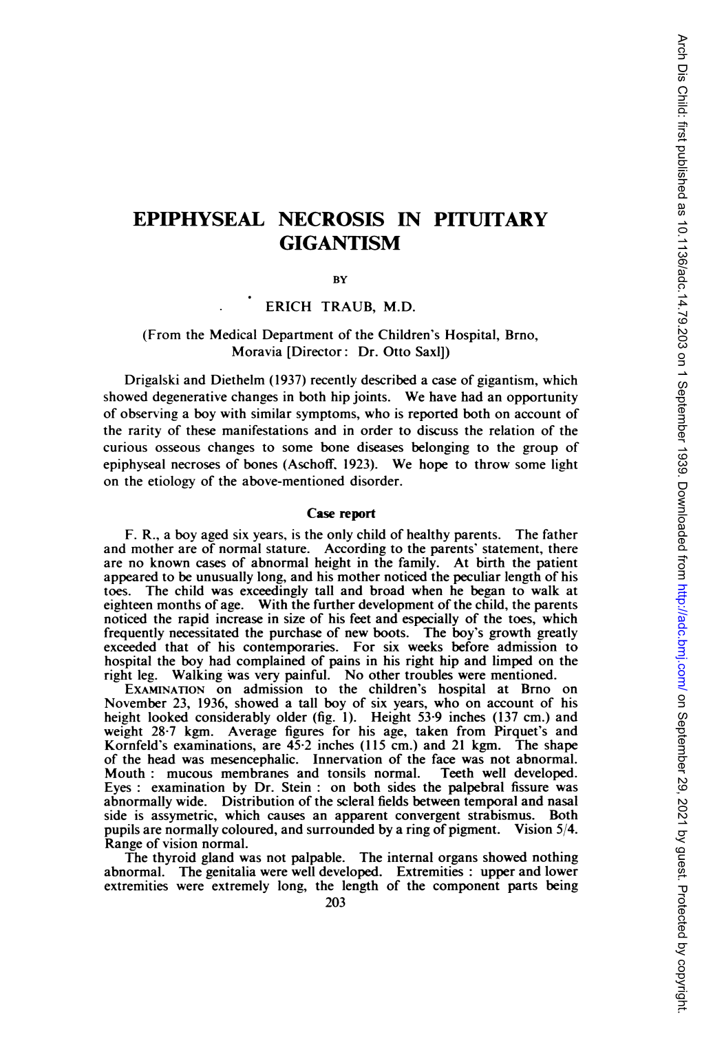 Epiphyseal Necrosis in Pituitary Gigantism