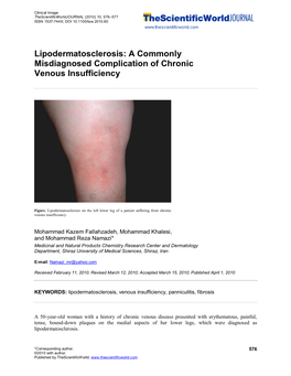 Lipodermatosclerosis: a Commonly Misdiagnosed Complication of Chronic Venous Insufficiency