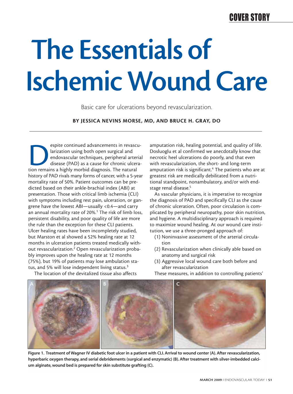 The Essentials of Ischemic Wound Care Basic Care for Ulcerations Beyond Revascularization