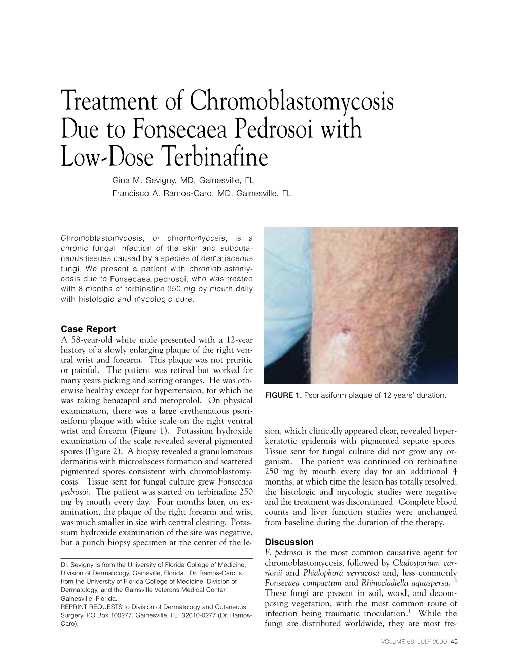 Treatment of Chromoblastomycosis Due to Fonsecaea Pedrosoi with Low-Dose Terbinafine Gina M